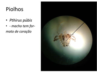 Piolhos
• Pthirus púbis
• - macho tem for-
mato de coração
 
