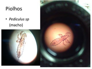 Piolhos
• Pediculus sp
(macho)
 