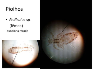 Piolhos
• Pediculus sp
(fêmea)
-bundinha raxada
 