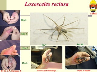 L U C E M A S P I C I O
Depto. P. Vegetal
CURLA
M. Sc. J. A. Banegas Z. Sección de Entomología
Loxosceles reclusa
Dia 3
Dia 4
Dia 5
Dia 6
Dia 9 Dia 10
 