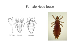 Female Head louse
 