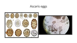 Ascaris eggs
 