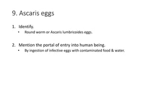 9. Ascaris eggs
1. Identify.
• Round worm or Ascaris lumbricoides eggs.
2. Mention the portal of entry into human being.
• By ingestion of infective eggs with contaminated food & water.
 