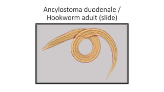 Ancylostoma duodenale /
Hookworm adult (slide)
 
