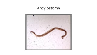 Ancylostoma
 