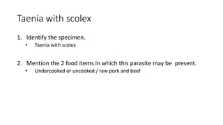 Taenia with scolex
1. Identify the specimen.
• Taenia with scolex
2. Mention the 2 food items in which this parasite may be present.
• Undercooked or uncooked / raw pork and beef
 