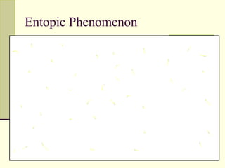 Entopic Phenomenon




            gs101lg@hotmail.com
 