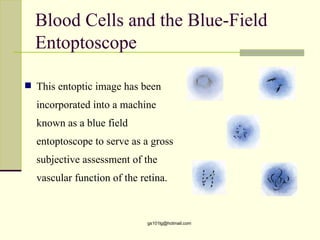 Blood Cells and the Blue-Field
  Entoptoscope

 This entoptic image has been

  incorporated into a machine
  known as a blue field
  entoptoscope to serve as a gross
  subjective assessment of the
  vascular function of the retina.



                             gs101lg@hotmail.com
 