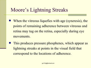 Moore’s Lightning Streaks
   When the vitreous liquefies with age (syneresis), the
    points of remaining adherence between vitreous and
    retina may tug on the retina, especially during eye
    movements.
   This produces pressure phosphenes, which appear as
    lightning streaks at points in the visual field that
    correspond to the locations of adherence.

                        gs101lg@hotmail.com
 