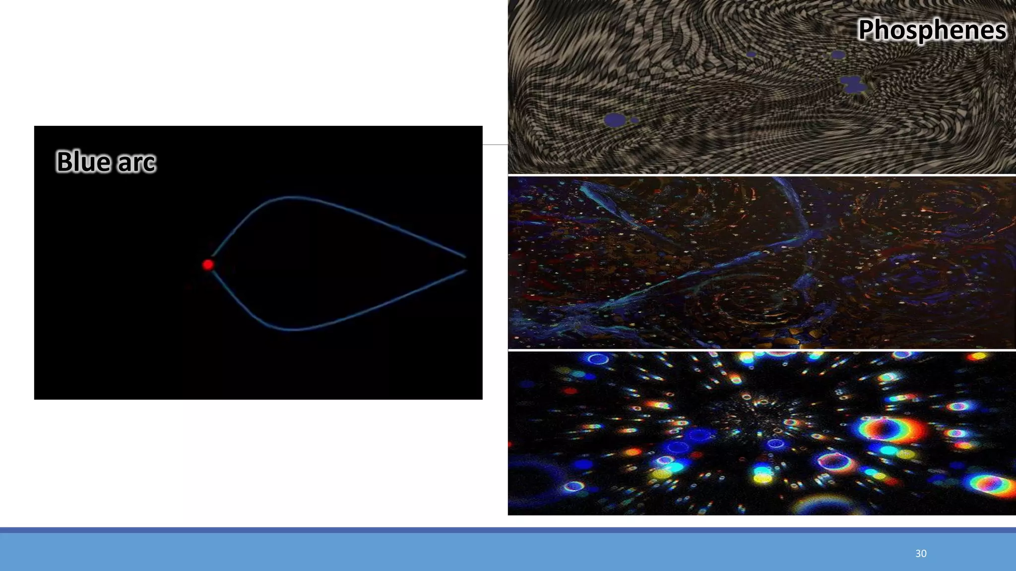Voluntary Entoptic Visualization Entoptic phenomena | PDF