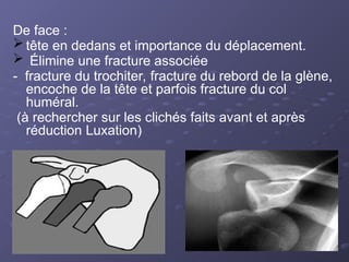 De face :
 tête en dedans et importance du déplacement.
 Élimine une fracture associée
- fracture du trochiter, fracture du rebord de la glène,
encoche de la tête et parfois fracture du col
huméral.
(à rechercher sur les clichés faits avant et après
réduction Luxation)
 