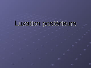 Luxation postérieure
Luxation postérieure
 