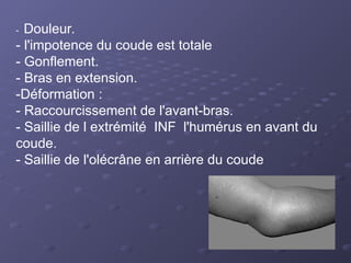 - Douleur.
- l'impotence du coude est totale
- Gonflement.
- Bras en extension.
-Déformation :
- Raccourcissement de l'avant-bras.
- Saillie de l extrémité INF l'humérus en avant du
coude.
- Saillie de l'olécrâne en arrière du coude
 