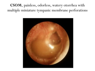 ent-osce-revision-pptx-pptx