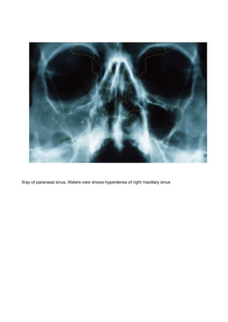 Walters View Ent part ii | PDF