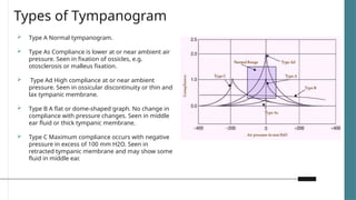 Tympanometry Graph Types Clinical and audiological interpretation of hearling loss | PPTX