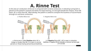 Clinical and audiological interpretation of hearling loss | PPTX