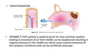 • TOYNBEE`S TEST: patient is asked to pinch his nose and then swallow
leading to movement of air from middle ear to nasopharynx resulting in
negative pressure in the middle ear which cause inward movement of
the tympanic membrane that can be verified by otoscope.
• CATHETERIZATION
 