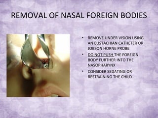 REMOVAL OF NASAL FOREIGN BODIES
• REMOVE UNDER VISION USING
AN EUSTACHIAN CATHETER OR
JOBSON HORNE PROBE
• DO NOT PUSH THE FOREIGN
BODY FURTHER INTO THE
NASOPHARYNX
• CONSIDER SEDATING OR
RESTRAINING THE CHILD
 