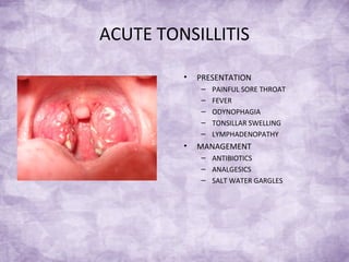 ACUTE TONSILLITIS
• PRESENTATION
– PAINFUL SORE THROAT
– FEVER
– ODYNOPHAGIA
– TONSILLAR SWELLING
– LYMPHADENOPATHY
• MANAGEMENT
– ANTIBIOTICS
– ANALGESICS
– SALT WATER GARGLES
 