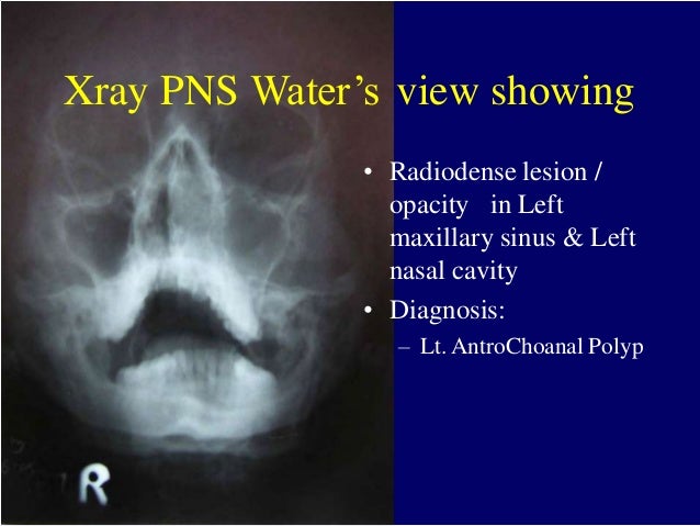 Ent radiology