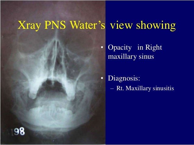 Ent Radiology