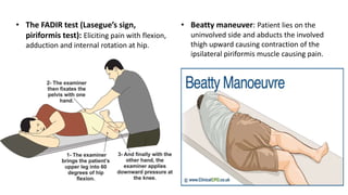 • The FADIR test (Lasegue’s sign,
piriformis test): Eliciting pain with flexion,
adduction and internal rotation at hip.
• Beatty maneuver: Patient lies on the
uninvolved side and abducts the involved
thigh upward causing contraction of the
ipsilateral piriformis muscle causing pain.
 