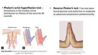 • Phalen’s wrist hyperflexion test :
Paresthesia in the median nerve
distribution on flexion of the wrist for 60
seconds
• Reverse Phalen’s test : has also been
found positive and useful but in moderate
to advanced compression predominantly.
 