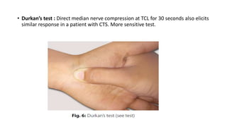 • Durkan’s test : Direct median nerve compression at TCL for 30 seconds also elicits
similar response in a patient with CTS. More sensitive test.
 