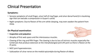 Clinical Presentation
Symptoms:
• Sensory symptoms of small finger, ulnar half of ring finger, and ulnar dorsal hand (it is localizing
sign that can exclude a compression in Guyon’s canal)
• Night symptoms: Due to flexion of the arm while sleeping, may even awaken the patient from
sleep.
On Physical examination:
• Inspection and palpation
• Atrophy of first web space and the interosseous muscles.
• Clawing of the ring and fifth finger. The clawing is due to loss of intrinsic muscles especially the
lumbricals that produce extension at the interphalangeal joint (IP) joint so there is flexion at the
IP joints
• MCP joint hyperextension.
• Subluxation of ulnar nerve on the medial epicondyle during flexion of elbow.
 