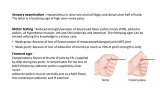 Sensory examination : Hypoesthesia in ulnar one and half digits and dorsal ulnar half of hand:
The latter is a localizing sign of high ulnar nerve palsy.
Motor testing : Reduced strength/paralysis of deep head flexor pollicis brevis (FPB), adductor
pollicis, all hypothenar muscles, 4th and 5th lumbricals and interossei. The following signs can be
elicited utilizing this knowledge in a classic case.
• Weak grasp: Because of loss of flexion power of metacarpophalangeal joint (MP) joint
• Weak pinch: Because of loss of adduction of thumb (as much as 70% of pinch strength is lost)
Froment sign :
Compensatory flexion of thumb IP joint by FPL (supplied
by AIN) during key pinch. It compensates for the loss of
(MCP) flexion by adductor pollicis supplied by ulnar
nerve.
Adductor pollicis muscle normally acts as a MCP flexor,
first metacarpal adductor, and IP extensor.
 