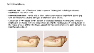 Extrinsic weakness
• Pollock’s test : Loss of flexion of distal IP joint of the ring and little finger—due to
weakness of two ulnar FDPs
• Bowden and Napier : Partial loss of wrist flexion with inability to perform power grip
with a neutral wrist (due to paralysis of the flexor carpi ulnaris)
• Conversion of “X” crease to “Y” pattern of intersected crease: Normally the little and
ring fingers are flexed fully into the palm on closing the fist to give an X configuration to
the folded creases of the little finger. Loss of DIP flexion in ulnar nerve palsy converts the
X configuration to a Y.
 