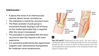 Submuscular :
• It places the nerve in an intermuscular
interval, where nerves normally run.
• The indication is mainly for recurrent cases.
• The flexor pronator muscle group is
transected sharply; leaving a cuff of tissue
on the medial epicondyle that is repaired
after the nerve is transposed.
• This procedure is associated with the least
recurrence rates but requires a bit more
experience.
• It is commonly preferred by the experienced
surgeons over subcutaneous transposition
for moderate nerve compressions.
 