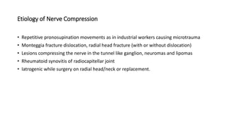 Etiology of Nerve Compression
• Repetitive pronosupination movements as in industrial workers causing microtrauma
• Monteggia fracture dislocation, radial head fracture (with or without dislocation)
• Lesions compressing the nerve in the tunnel like ganglion, neuromas and lipomas
• Rheumatoid synovitis of radiocapitellar joint
• Iatrogenic while surgery on radial head/neck or replacement.
 