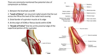 There are commonly mentioned five potential sites of
compression as follows:
1. Between the brachialis and BR
2. “Leash of Henry” are recurrent radial vessels that fan out
across the PIN at the level of the radial neck causing
3. Distal border of supinator muscle at its edge
4. At the origin of ECRB or fibrous bands within ECRB
5. “Arcade of Frohse” that lies at the proximal edge of the
superficial portion of the supinator.
 