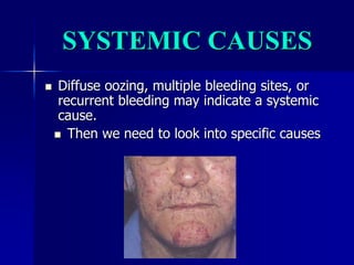 SYSTEMIC CAUSES
 Diffuse oozing, multiple bleeding sites, or
recurrent bleeding may indicate a systemic
cause.
 Then we need to look into specific causes
 