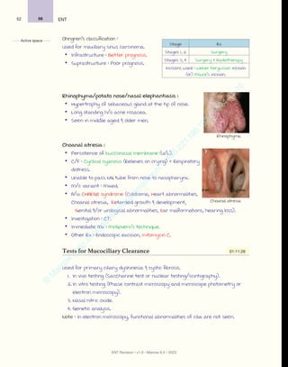Learn ent with crash course in one hour.pdf