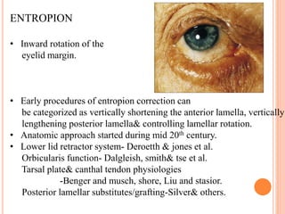 ENTROPION
• Inward rotation of the
eyelid margin.
• Early procedures of entropion correction can
be categorized as vertica...