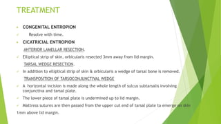 TREATMENT
 CONGENITAL ENTROPION
 Resolve with time.
 CICATRICIAL ENTROPION
ANTERIOR LAMELLAR RESECTION.
 Elliptical strip of skin, orbicularis resected 3mm away from lid margin.
TARSAL WEDGE RESECTION.
 In addition to elliptical strip of skin & orbicularis a wedge of tarsal bone is removed.
TRANSPOSITION OF TARSOCONJUNCTIVAL WEDGE
 A horizontal incision is made along the whole length of sulcus subtarsalis involving
conjunctiva and tarsal plate.
 The lower piece of tarsal plate is undermined up to lid margin.
 Mattress sutures are then passed from the upper cut end of tarsal plate to emerge on skin
1mm above lid margin.
 