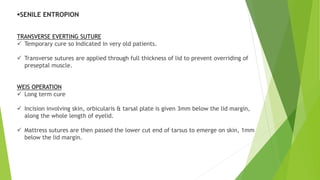 SENILE ENTROPION
TRANSVERSE EVERTING SUTURE
 Temporary cure so Indicated in very old patients.
 Transverse sutures are applied through full thickness of lid to prevent overriding of
preseptal muscle.
WEIS OPERATION
 Long term cure
 Incision involving skin, orbicularis & tarsal plate is given 3mm below the lid margin,
along the whole length of eyelid.
 Mattress sutures are then passed the lower cut end of tarsus to emerge on skin, 1mm
below the lid margin.
 
