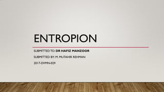 ENTROPION
SUBMITTED TO: DR HAFIZ MANZOOR
SUBMITTED BY: M. MUTAHIR REHMAN
2017-DVMN-029
 