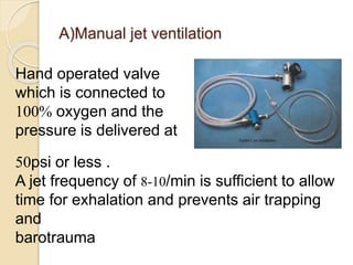 A)Manual jet ventilation
Hand operated valve
which is connected to
100% oxygen and the
pressure is delivered at
50psi or less .
A jet frequency of 8-10/min is sufficient to allow
time for exhalation and prevents air trapping
and
barotrauma
 