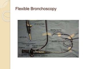 Flexible Bronchoscopy
 