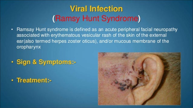 External Ear disease