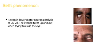 ENT sign and triades by Dr.Muhammad Sherwani.pptx