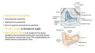 Trautsmann Triangle ENT sign and triades by Dr.Muhammad Sherwani.pptx