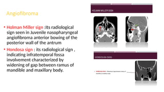 ENT sign and triades by Dr.Muhammad Sherwani.pptx