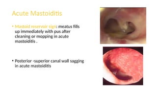 ENT sign and triades by Dr.Muhammad Sherwani.pptx