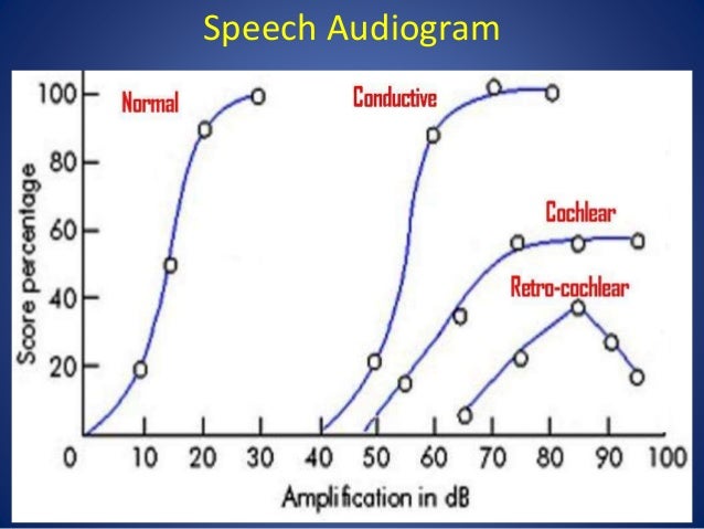 audiometry