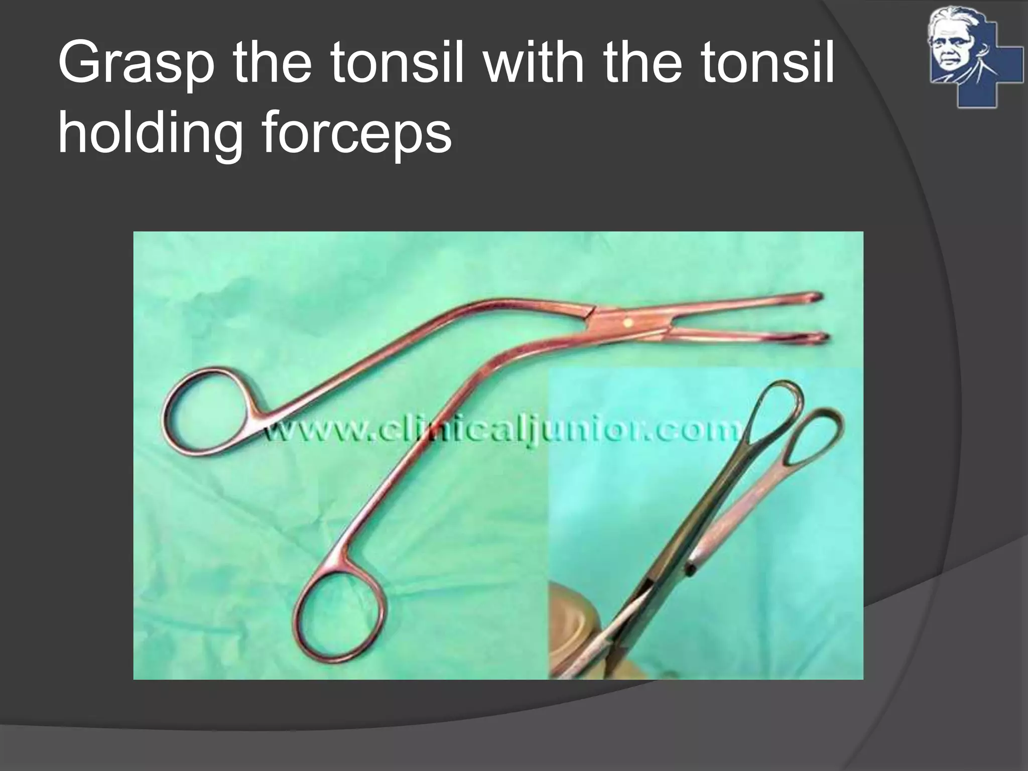 Grasp the tonsil with the tonsil
holding forceps
 